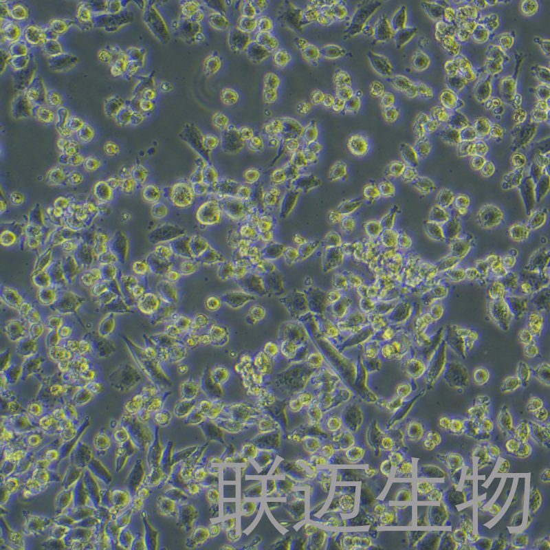 MIAPaCa-2细胞（胰腺癌细胞STR鉴定正确）LM8C0627