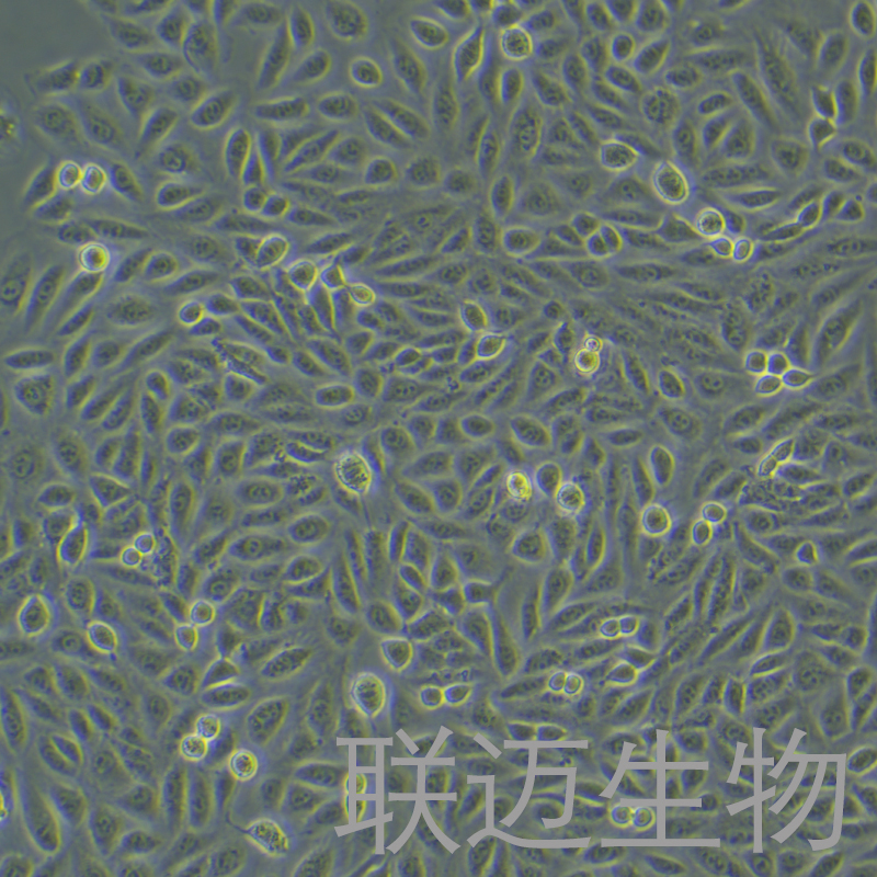 TPC-1细胞（甲状腺癌细胞STR鉴定正确）LM8C0643