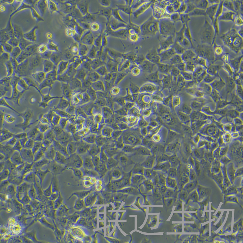 NCI-H1975细胞（肺腺癌细胞STR鉴定正确）LM8C0298
