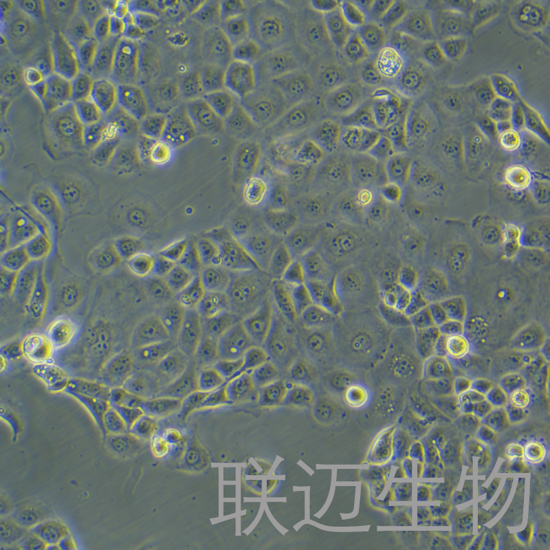NIH:OVCAR-3[OVCAR3]细胞（卵巢癌细胞STR鉴定正确）LM8C0178
