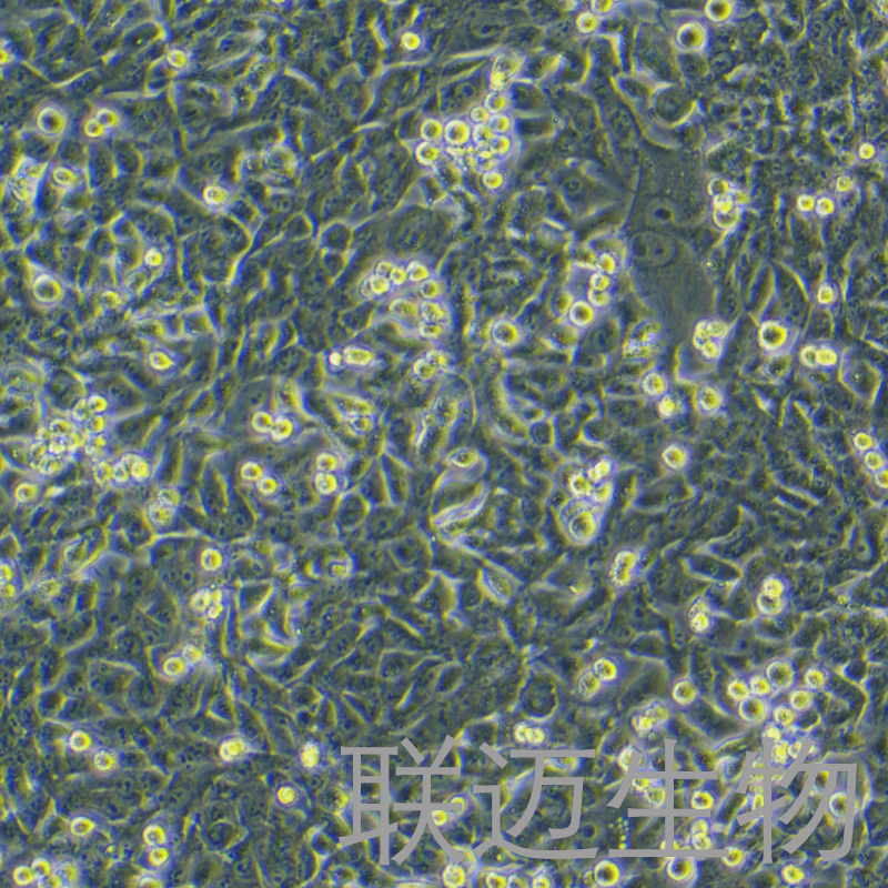SK-Hep-1细胞（肝癌细胞STR鉴定正确）LM8C0212