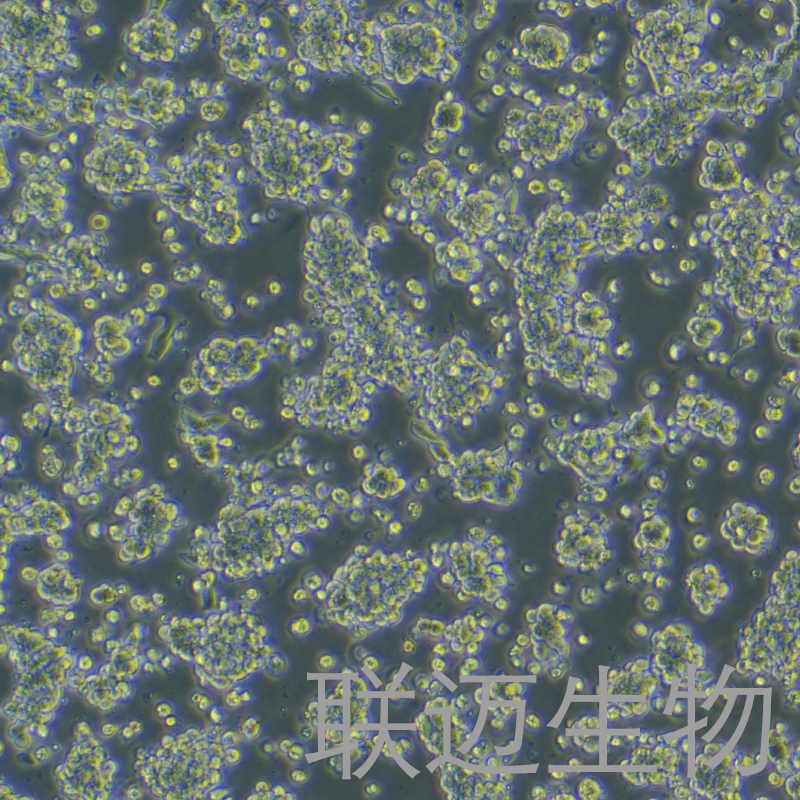 VCaP细胞（前列腺癌细胞STR鉴定正确）LM8C0241