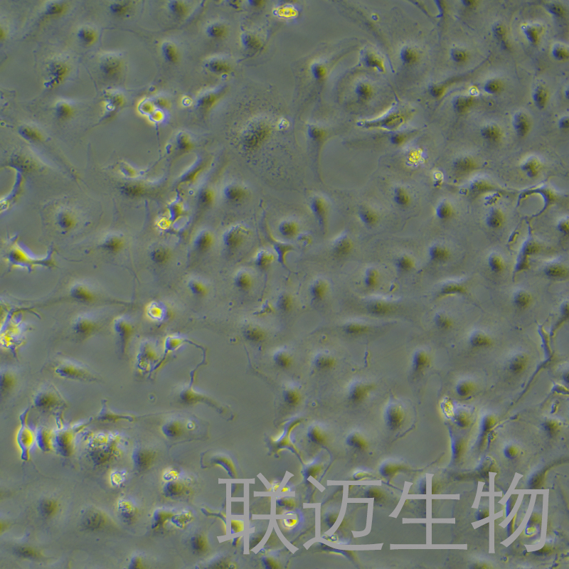 LX-2细胞（肝星形细胞STR鉴定正确）LM8C0560