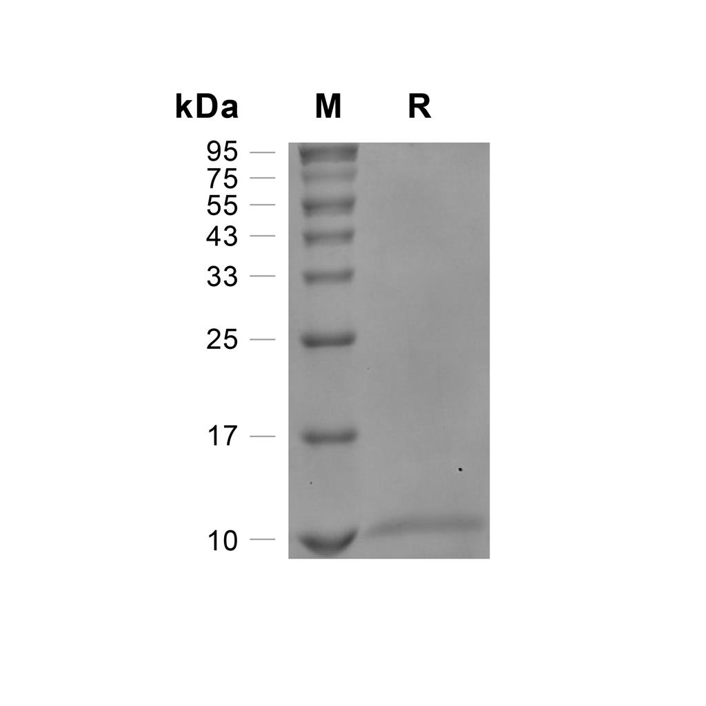 SDF-1 beta/CXCL12蛋白, Human (72a.a)
