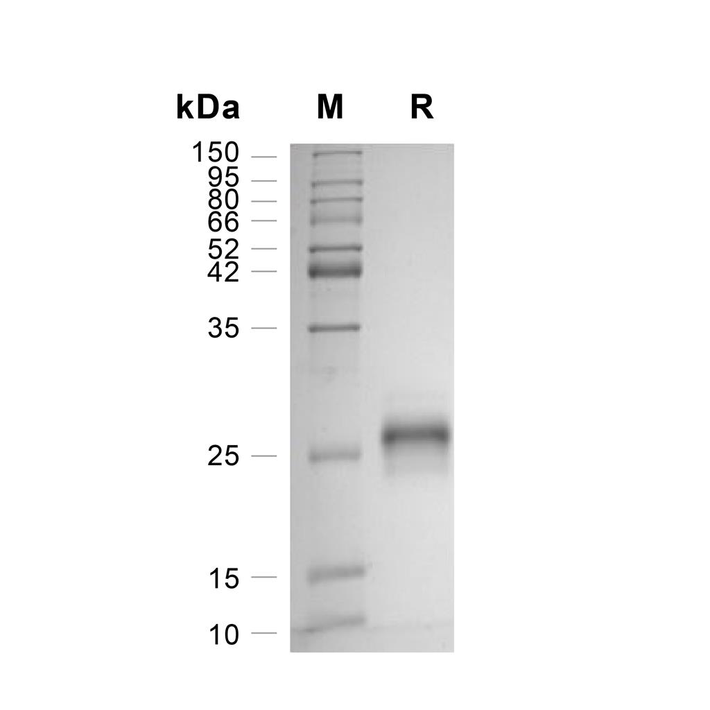 Ephrin-A1/EFNA1蛋白, Human (AAH32698.1, HEK293, His)