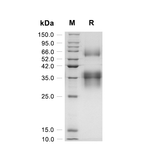 Clusterin/APOJ蛋白, Human (HEK293, His)
