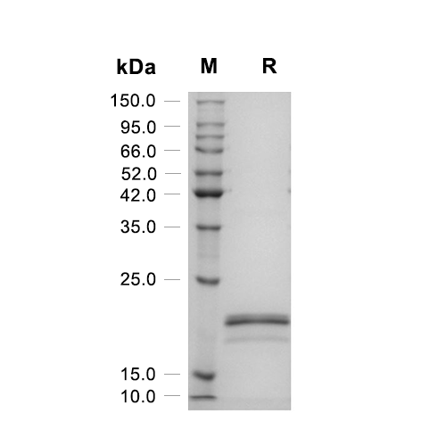 FGF-12蛋白, Human (177 a.a)