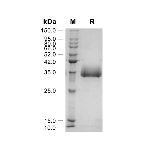Galectin-3/LGALS3蛋白, Human (HEK293, His)