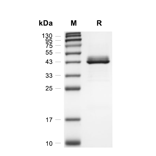 Spondin-2/SPON2蛋白, Human (HEK293, His)