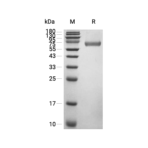 TNFRSF11B/OPG蛋白, Human (CHO, Fc)