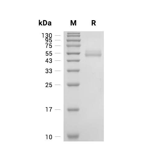 B4GALT1蛋白, Human (HEK293, Y285L, His)