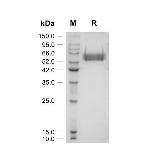 IL-15R alpha & IL-15蛋白, Human (HEK293, Fc)