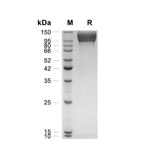 Integrin beta-1/CD29蛋白, Human (HEK293, His)