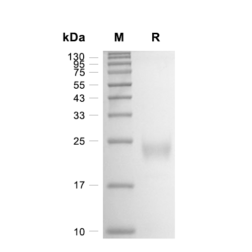HE4/WFDC2蛋白, Human (HEK293, His)