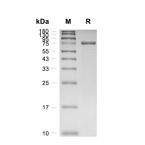 SLP-76蛋白, Human (His-T7)