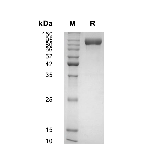 Myeloperoxidase/MPO蛋白, Mouse (HEK293, His)