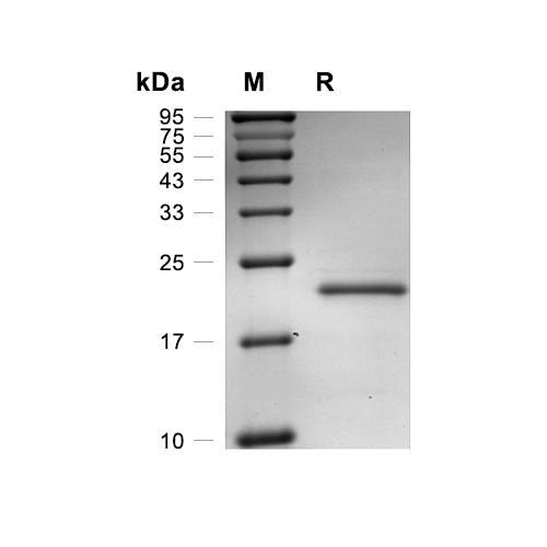 Hemoglobin subunit alpha/HBA1蛋白, Human (His)