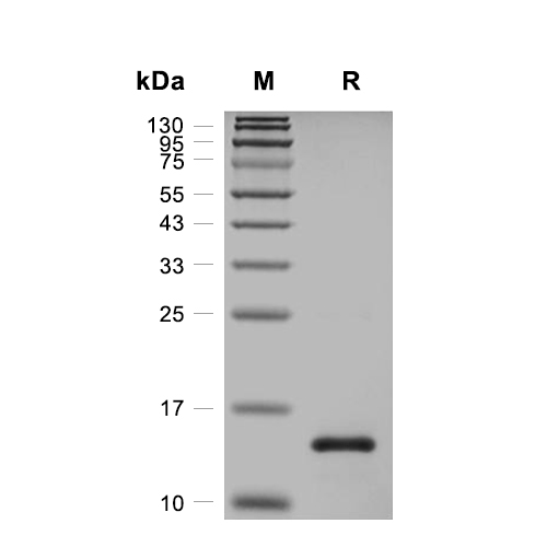 SAA1蛋白, Human (His)