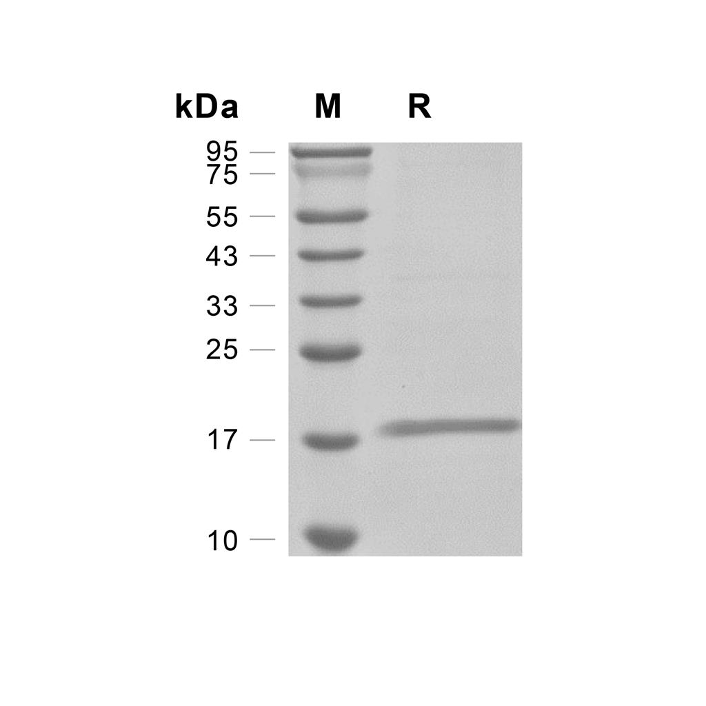 Protein E7, HPV16 (His)