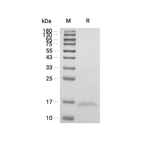 SAA4蛋白, Human (His)