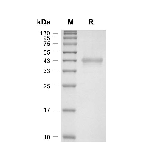 Placenta-expressed transcript 1蛋白, Mouse (His-SUMO)
