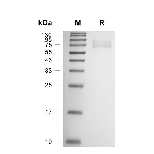 GUCY2C/Guanylyl cyclase C蛋白, Rat (HEK293, Myc, His)