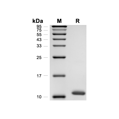 GYPA/CD235a蛋白, Human (His)