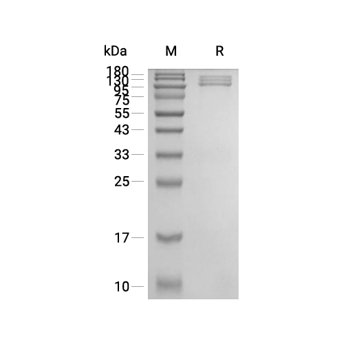 Integrin alpha V beta 3蛋白, Human (HEK293, His, solution)