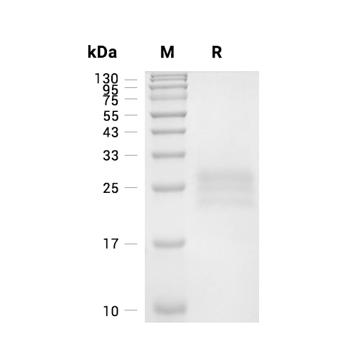 IL-25/IL-17E蛋白, Human (HEK293, His)