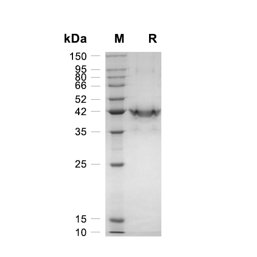 IL-1RA/IL-1RN蛋白, Rat (HEK293, Fc)