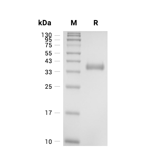 Granzyme H/GZMH蛋白, Human (HEK293, His)