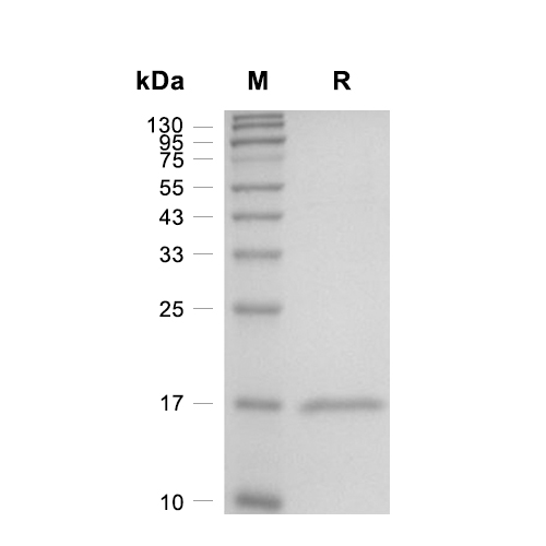 Capsid蛋白, Hepatitis B Virus (His)