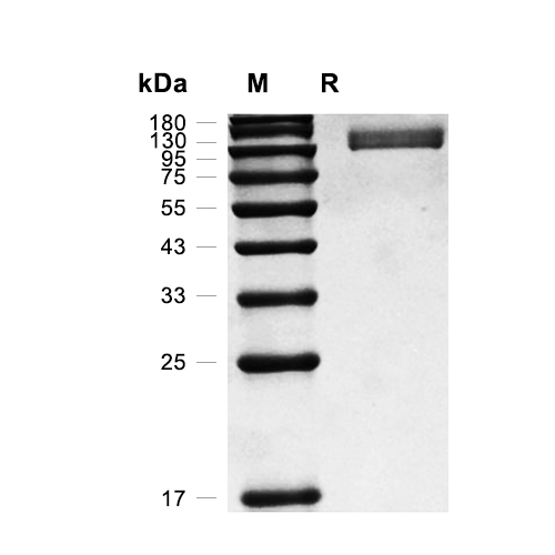 Nicastrin蛋白, Mouse (HEK293, His)