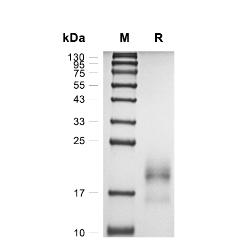 BAMBI/NMA蛋白, Human (HEK293, His)