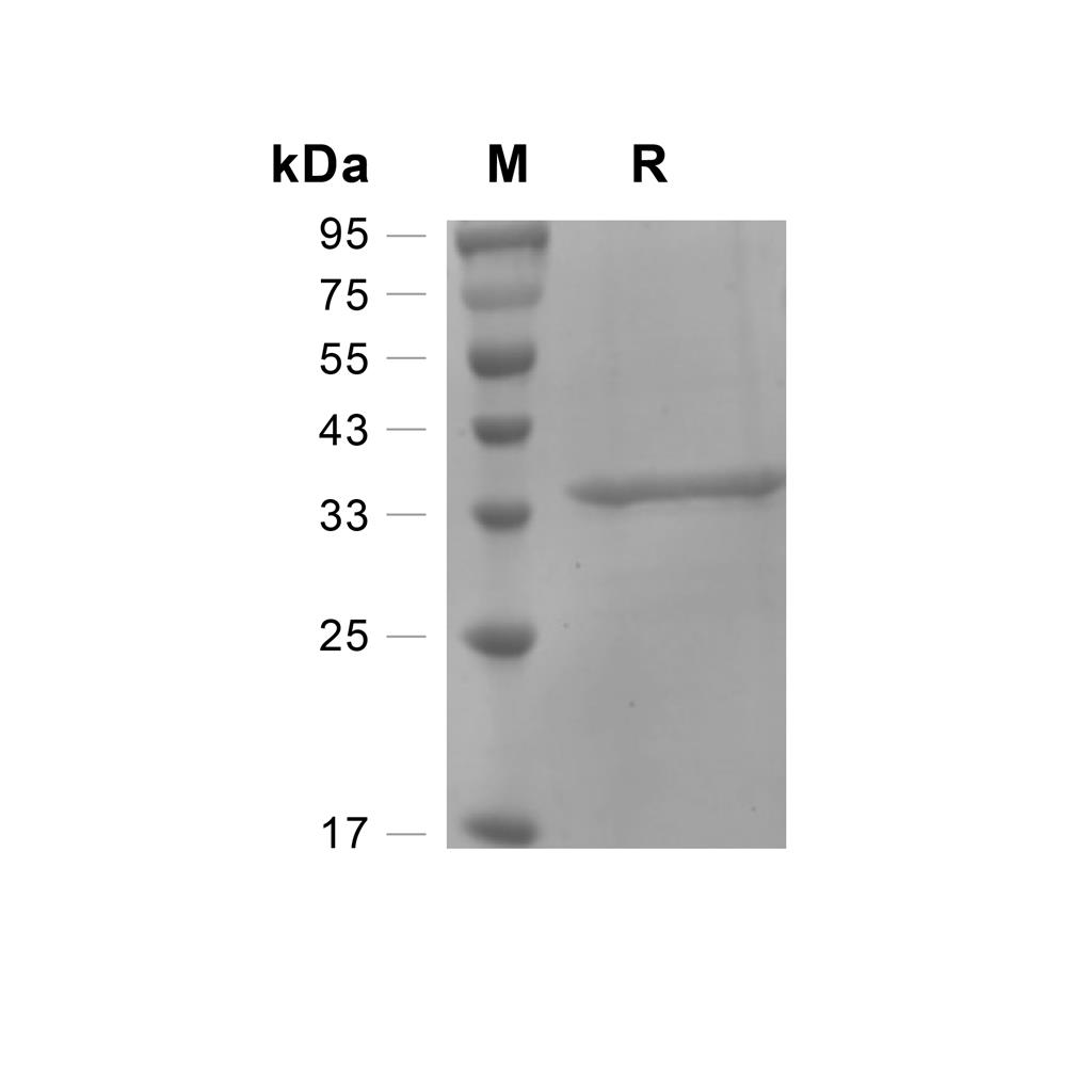OTUB1蛋白, Human (His)