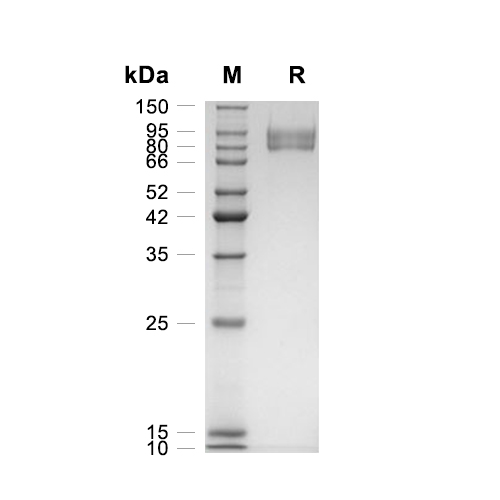 gp130/IL6ST蛋白, Mouse (HEK293, His)