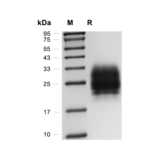 SCN2B蛋白, Human (HEK293, His)