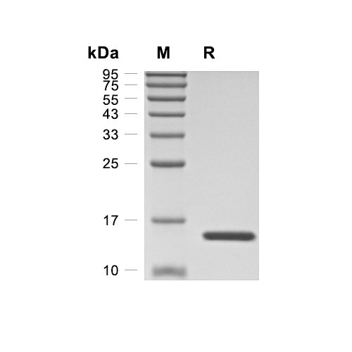 CD3 zeta/CD247蛋白, Human (His)