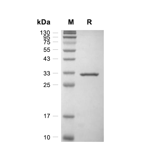 COASY蛋白, Human (His)