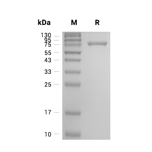 Semaphorin-7A/SEMA7A蛋白, Human (HEK293, His)
