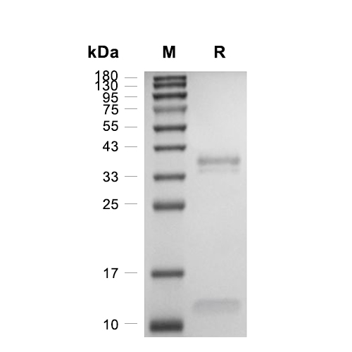 CD1E-B2M Heterodimer蛋白, Cynomolgus (HEK293, His)