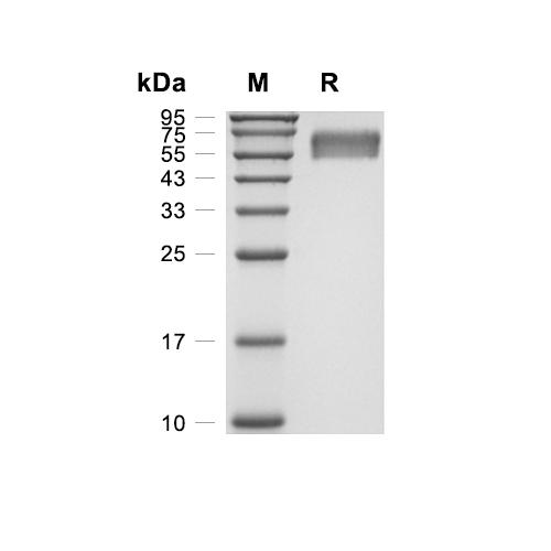 IL-1RAcP/IL-1 R3蛋白, Rhesus Macaque (HEK293, His)