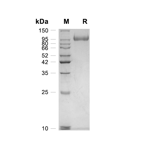 Sortilin/SORT1蛋白, Human (HEK293, His)