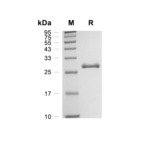SENP1 Catalytic Domain蛋白, Human (His)