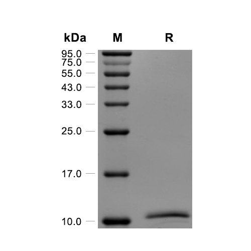Neuritin蛋白, Human (N-His)