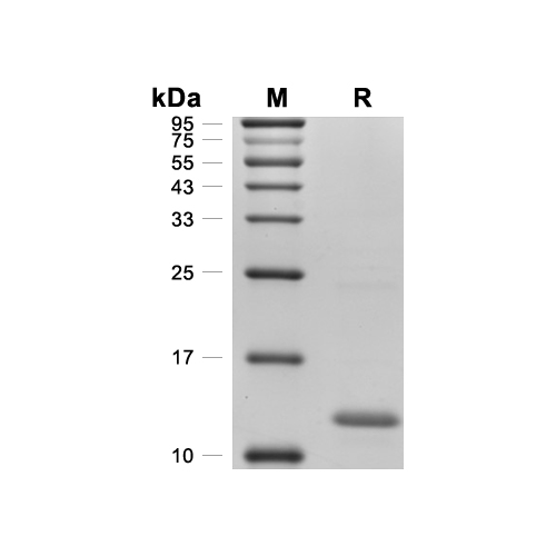 CCL6蛋白, Rat (N-His)