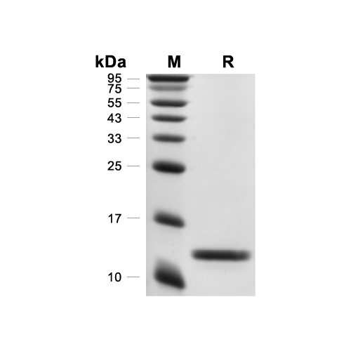 CXCL14/BRAK蛋白, Rat (N-His)