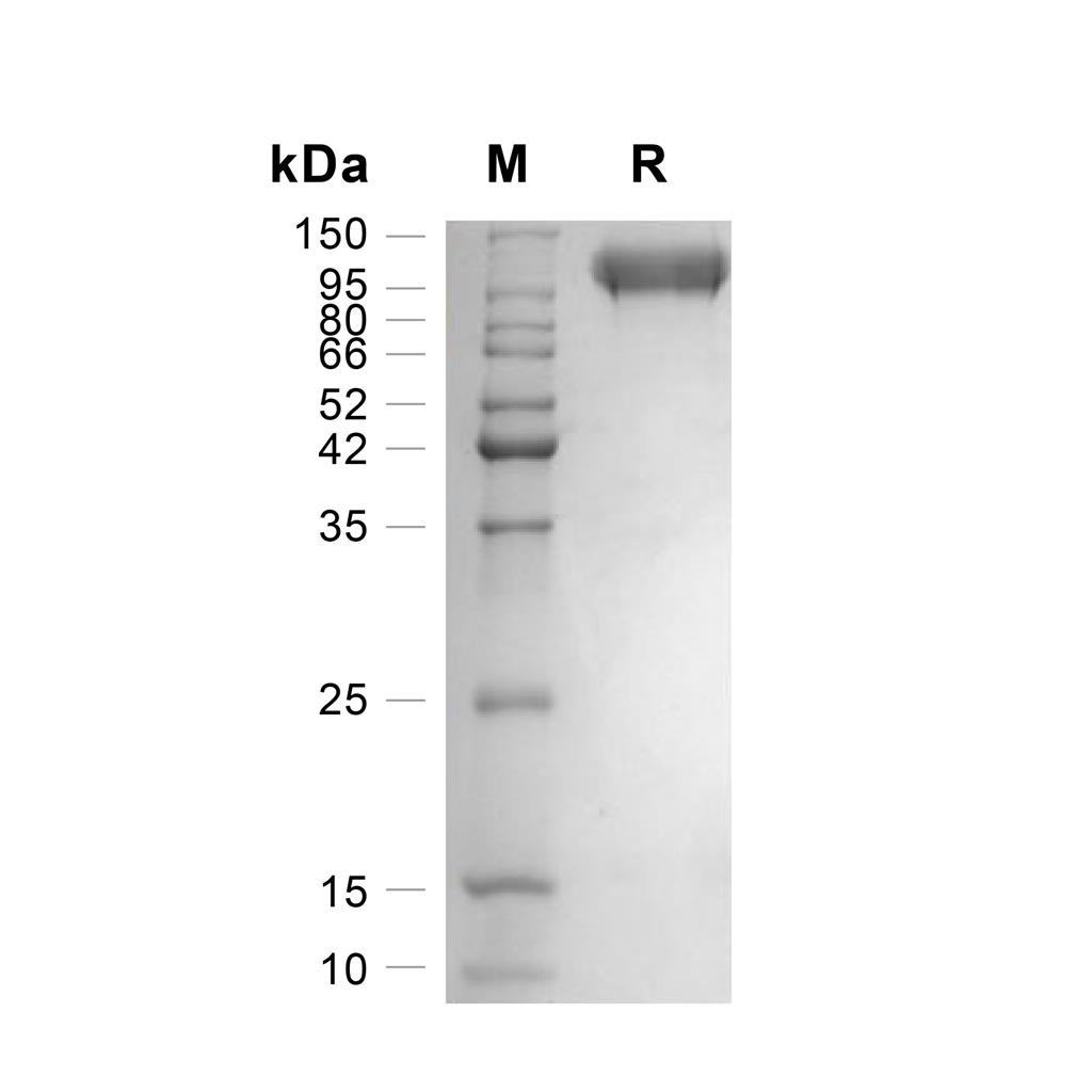 alpha Actinin 4/ACTN4蛋白, Human (HEK293, C-His)
