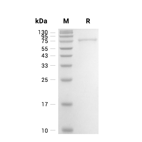 DDX5蛋白, Human (His, Myc)