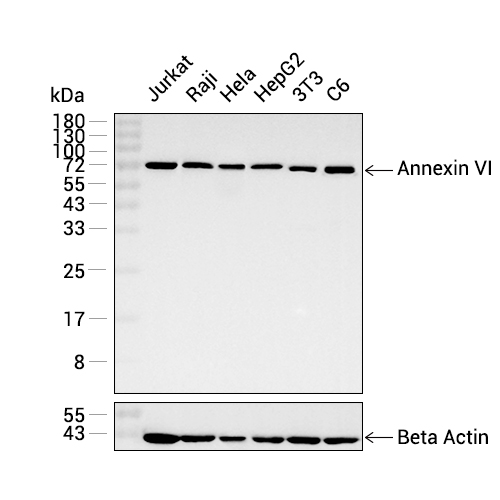 Annexin VI抗体 (YA618)